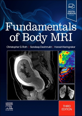Fundamentals of Body MRI - Roth, Christopher G, MD, and Naringrekar, Haresh, and Deshmukh, Sandeep, MD