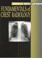 Fundamentals of Chest Radiology