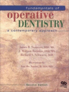 Fundamentals of Operative Dentistry: A Contemporary Approach