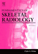 Fundamentals of Skeletal Radiology