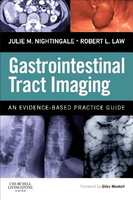 Gastrointestinal Tract Imaging: An Evidence-Based Practice Guide - Nightingale, Julie (Editor), and Law, Robert (Editor)