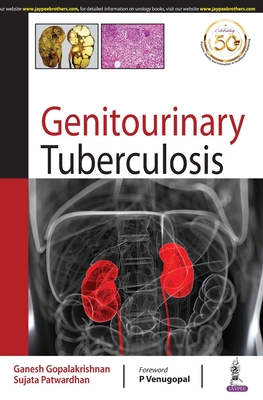 Genitourinary Tuberculosis - Gopalakrishnan, Ganesh, and Patwardhan, Sujata