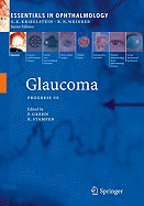 Glaucoma: Process III