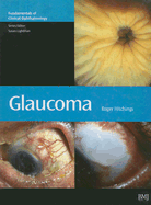 Glaucoma
