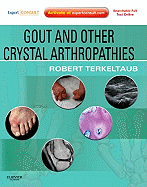 Gout and Other Crystal Arthropathies