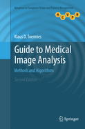 Guide to Medical Image Analysis: Methods and Algorithms