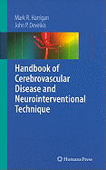 Handbook of Cerebrovascular Disease and Neurointerventional Technique