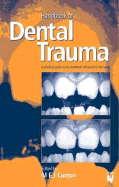 Handbook of Dental Trauma