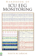 Handbook of ICU EEG Monitoring