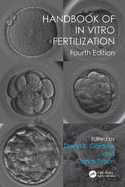 Handbook of in Vitro Fertilization
