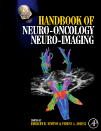 Handbook of Neuro-Oncology Neuroimaging