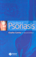 Handbook of Psoriasis