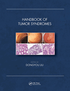 Handbook of Tumor Syndromes
