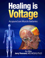 Healing is Voltage: Acupuncture Muscle Batteries