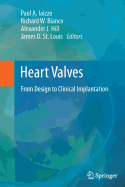 Heart Valves: From Design to Clinical Implantation