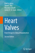Heart Valves: From Design to Clinical Implantation