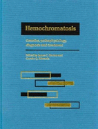 Hemochromatosis: Genetics, Pathophysiology, Diagnosis and Treatment