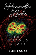 Henrietta Lacks the Untold Story