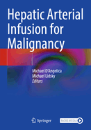 Hepatic Arterial Infusion for Malignancy
