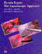 Hernia Repair: The Laparoscopic Approach