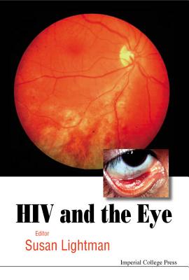 HIV and the Eye - Lightman, Susan (Editor)