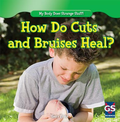 How Do Cuts and Bruises Heal? - Frick, Gary