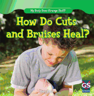 How Do Cuts and Bruises Heal?