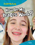 How Do My Braces Work?: Teeth