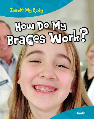 How Do My Braces Work?: Teeth - Parker, Steve