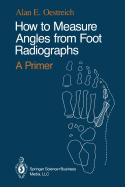 How to Measure Angles from Foot Radiographs: A Primer