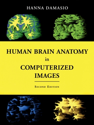 Human Brain Anatomy in Computerized Images - Damasio, Hanna, M.D.