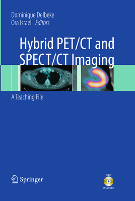 Hybrid Pet/CT and Spect/CT Imaging: A Teaching File - Delbeke, Dominique, MD, PhD (Editor), and Israel, Ora (Editor)