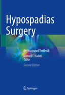 Hypospadias Surgery: An Illustrated textbook