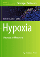 Hypoxia: Methods and Protocols