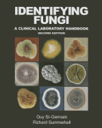 Identifying Fungi: A Clinical Laboratory Handbook