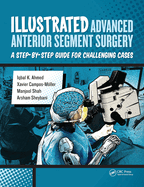 Illustrated Advanced Anterior Segment Surgery: A Step-By-Step Guide for Challenging Cases