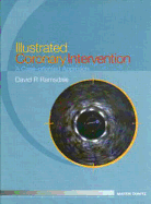 Illustrated Coronary Intervention: A Case Oriented Approach