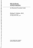 Illustrated Guide to Anesthesia