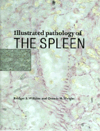 Illustrated Pathology of the Spleen