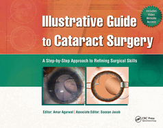 Illustrative Guide to Cataract Surgery: A Step-By-Step Approach to Refining Surgical Skills