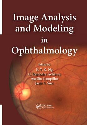 Image Analysis and Modeling in Ophthalmology - Ng, Eddie Y. K. (Editor), and Acharya, U. Rajendra (Editor), and Suri, Jasjit S. (Editor)