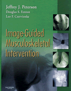 Image-Guided Musculoskeletal Intervention
