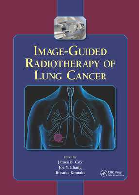 Image-Guided Radiotherapy of Lung Cancer - Cox, James D (Editor), and Chang, Joe Y (Editor), and Komaki, Ritsuko (Editor)