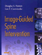 Image-Guided Spine Intervention
