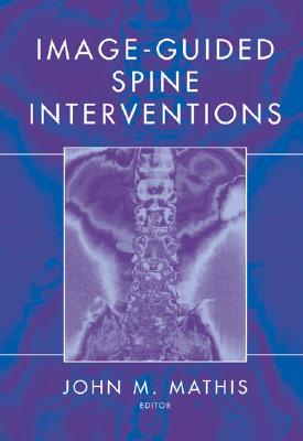 Image-Guided Spine Interventions - Johnson, Blake A, and Staats, Peter S, and Mathis, John M (Editor)