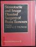Stereotactic and Image Directed Surgery of Brain Tumours