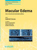 Macular Edema