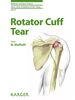 Rotator Cuff Tear