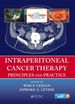 Intraperitoneal Cancer Therapy