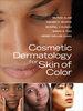 Cosmetic Dermatology for Skin of Color